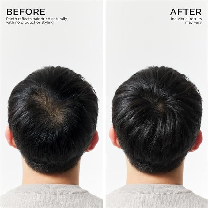 Dr. Groot Hair Thickening Shampoo, Korean Hair Care with Biotin, Rosemary Oil to Help Volumize Thinning, Damaged Hair, Hydrate Hair and Scalp, Biotin Shampoo, Scalp Revitalizing Solution