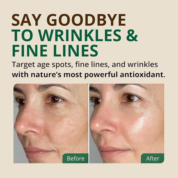 Vitamin E Oil - 100% Pure & Natural, 85,800 IU. Repair Dry, Damaged Skin from Surgery & Acne, Age Spots & Wrinkles. Boost Collagen for Moisturized, Youthful-looking Skin. d-alpha tocopherol, 2 Fl Oz