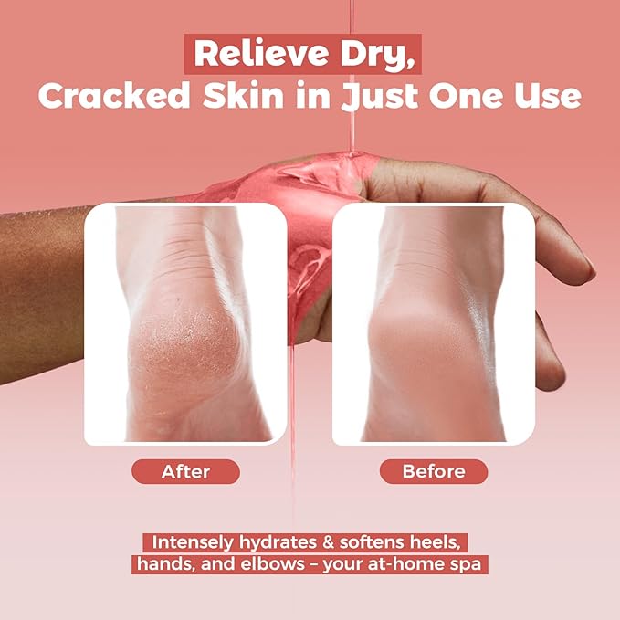 Paraffin Wax Refills 10 Packs for Paraffin Wax Bath Machine - for Dry Cracked Skin on Hands, Feet, Elbows - Moisturizing Hydration to Relieve Stiff Muscles & Joints (Rose)