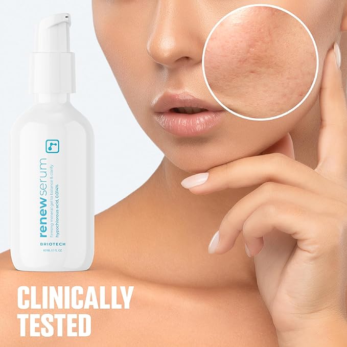 BRIOTECH Renew Serum, Hypochlorous Acid Mineral Gel, Soften Fine Line Appearance, Smooth Skin for Face, Neck, Chest, Spot Corrector, Soothe Redness, Vegan, 2 fl oz