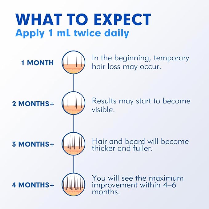 5% Minoxidil for Men, Extra Strength Hair Growth Serum, Beard Growth Oil, Fast Absorbing Dropper, Non Greasy, Low Residue Formula, 2-Pack for 2 Months, Hair Regrowth Treatment for Thinning Hair