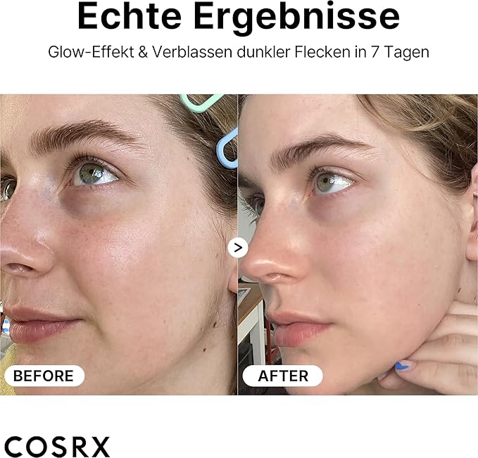 COSRX Pure Vitamin C 23% Serum with Vitamin E & Hyaluronic Acid, Hydrating Facial Serum for Fine Lines, Uneven Skin Tone & Dull Skin, 0.7oz/20g, Korean Skin Care