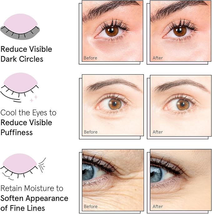 grace & stella Award Winning Under Eye Mask - Travel Size Toiletries - Bridal Shower Gifts - Gel Eye Patches for Dark Circles, Puffy Eyes, Wrinkles, Undereye Bags - Vegan - Self Care (6 Pairs, Gold)