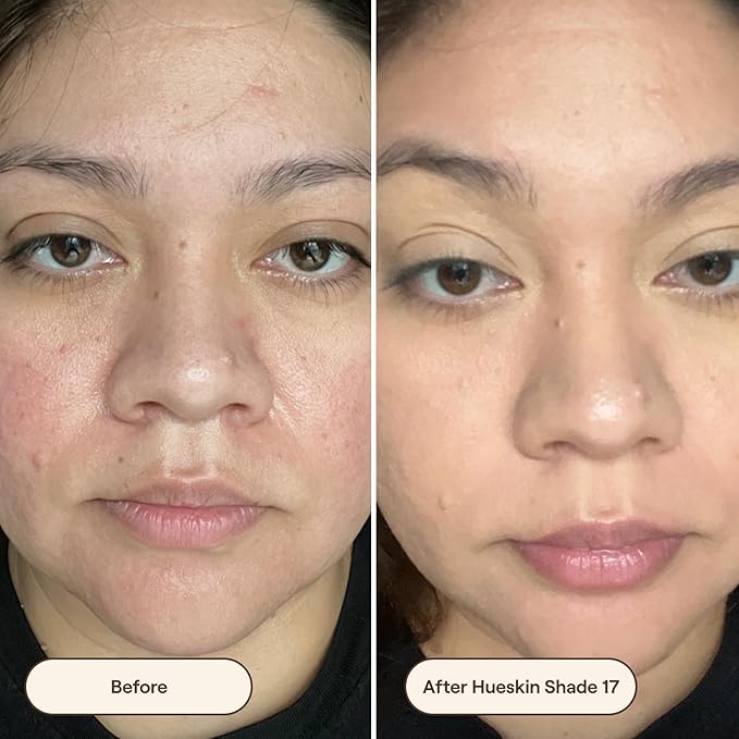 Live Tinted Hueskin Serum Concealer - Medium-to-Full Coverage Concealer with Niacinamide, & Hyaluronic Acid for Dark Circles, Fine Lines & Wrinkles, Buildable Long-Lasting Formula, 0.35 oz Shade 17