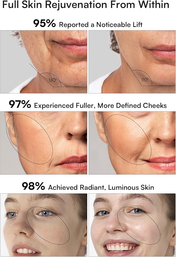 INIA 3-in-1 Red Light Therapy for Face and Neck Beauty Device for Puffiness & Skin Firming Skincare Tool (Black)