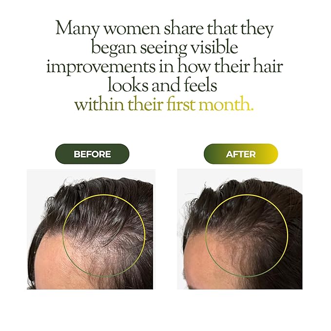 regener8 3-in-1 Hormonal Hair Loss & Thinning Treatment - Scalp Reset System With Multi-Signal Hair Growth Oil, Scalp Massage Brush & Cortisol-Reducing Candle - Complete Hair Revival Bundle for Women