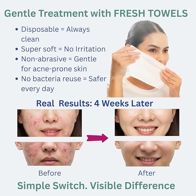 FRESH TOWELS Disposable Face Towels, Makeup Removal Face Towelettes & Dry Wipes, 300 Ct, 6 Packs