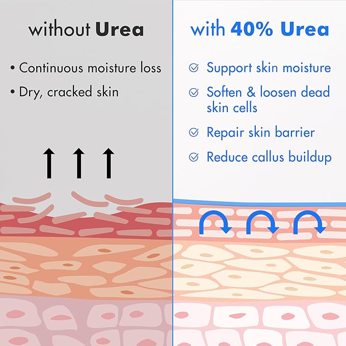 Ebanel Urea Cream 40% plus Salicylic Acid 2%, Foot Cream for Dry Cracked Heels Feet Knees Elbows Hands, Foot Dead Skin Cuticle Callus Remover Toenail Softener, Keratolytic Skin Barrier Repair, 3-Pack