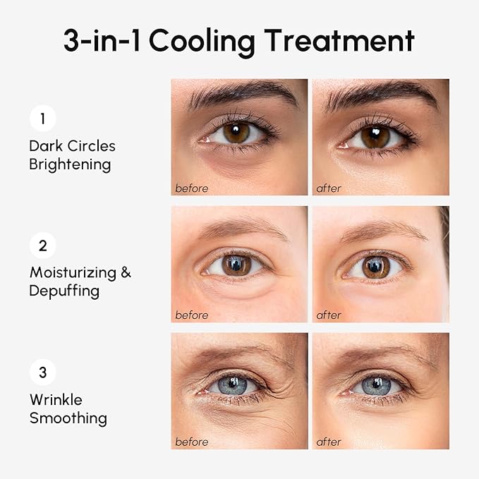 MAREE Hydrating Under Eye Patches for Puffy Eyes and Dark Circles – Marine Collagen & Caffeine Eye Patches – Brightening Eye Patche with Niacinamide – Depuffing Eye Mask for Dark Circles and Puffiness