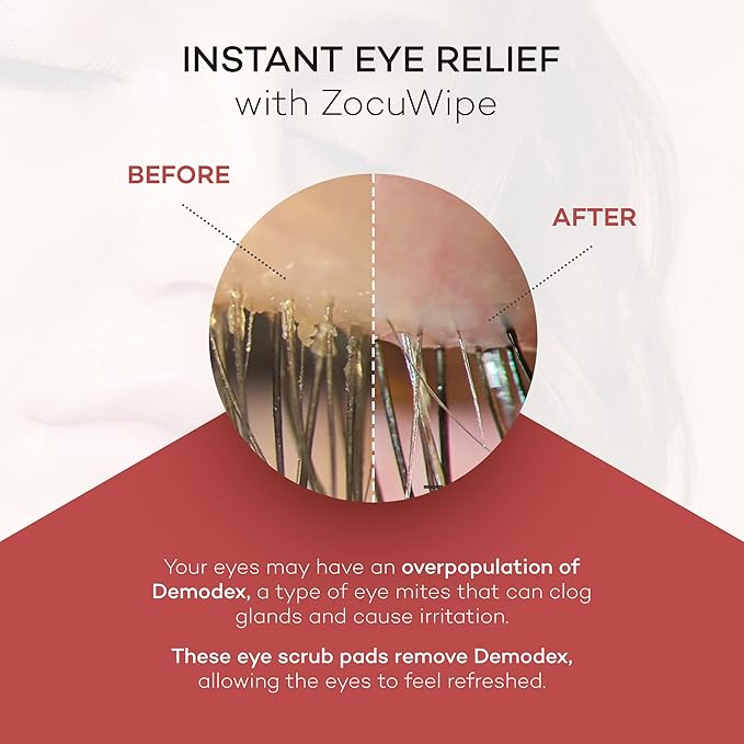 Zocuwipe Eyelid Wipes with Natural Okra Complex - Eyelid Cleanser and Moisturizer Pads for Irritated, Red Eyes from Dry Eye, Blepharitis 30ct