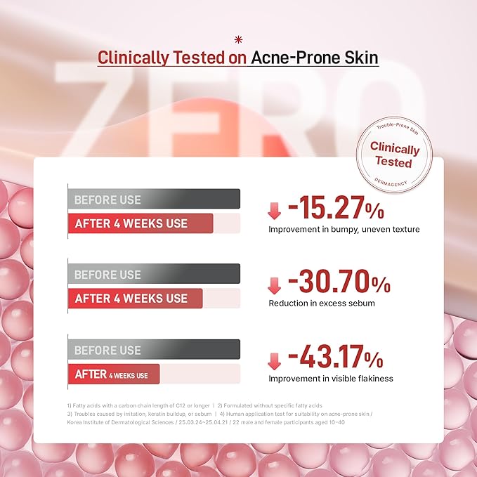 Zeroca 86 Korean Toner for Acne-Prone & Oily Skin – Fast Calming & Soothing for Breakout Relief – Calms Redness & Supports Clear Skin (6.76 fl.oz. 200ml)