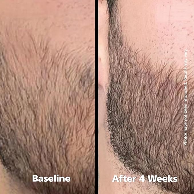 DABALASH Men Professional Facial Hair, Eyelash & Brow Growth Serum with Castor Oil – Promotes the Appearance of Naturally Longer, Fuller, Thicker & Stronger Hair – 0.18 oz