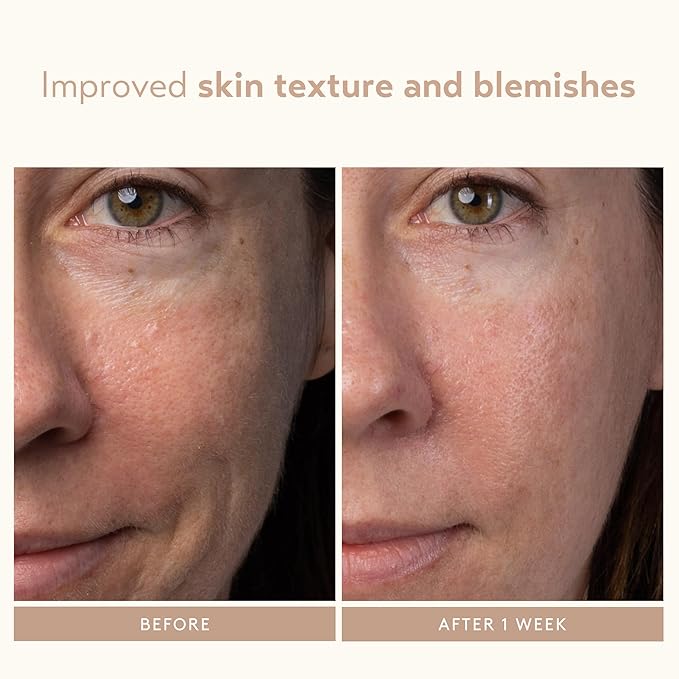 SHANI DARDEN SKIN CARE Lactic Acid Face Serum, Active Night Serum to Help with the Look of Radiant and Smooth Skin, Gentle But Powerful Face Exfoliator, 1.01 fl oz
