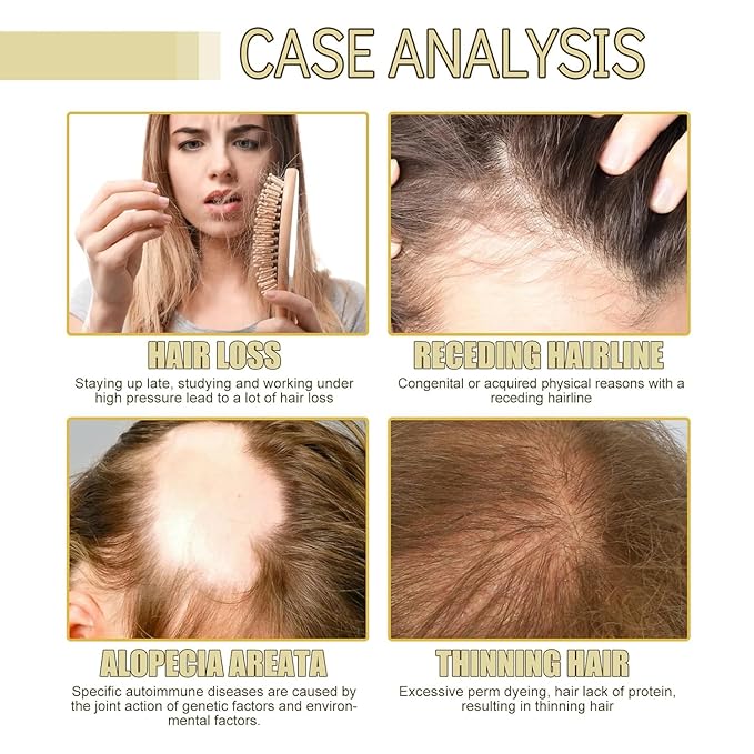 120ML Natural Hair Growth, Rosemary Oil for Hair Growth Organic, Rosemary Oil for Dry Damaged Hair and Growth Thin Hair （2PCS）
