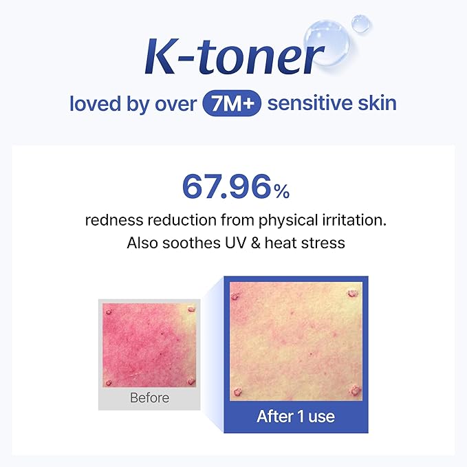 [KLAIRS] Supple Preparation Unscented Toner 6.08 fl oz, Lightweight, Essential Oil-Free, Alcohol Free, Packaging Changed