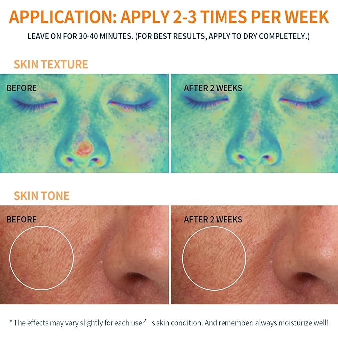 Firming and Moisturizing Sheet Face Masks (Pack of 10) with Hyaluronic Acid and Peptides, Reduce Fine Lines and Wrinkles, Hydrating & Anti-Aging Spa Face Mask, Facial Skin Care