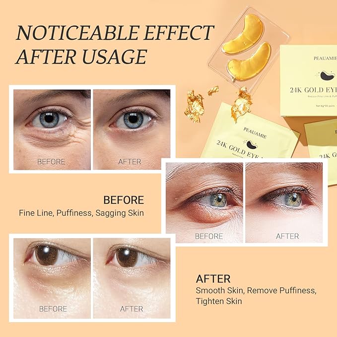 Under Eye Patchs 24k Gold Eye Mask and Hyaluronic Acid and Rose for Dark Circles and Puffiness Wrinkle Eye Bags 30 Pairs