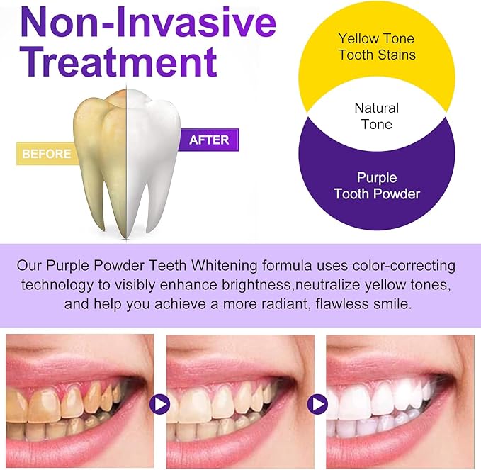 Teeth Whitening Powder - Teeth Whitening - Removes Stains - No Sensitivity - Toothpaste Power - Breath Freshener - for Coffee