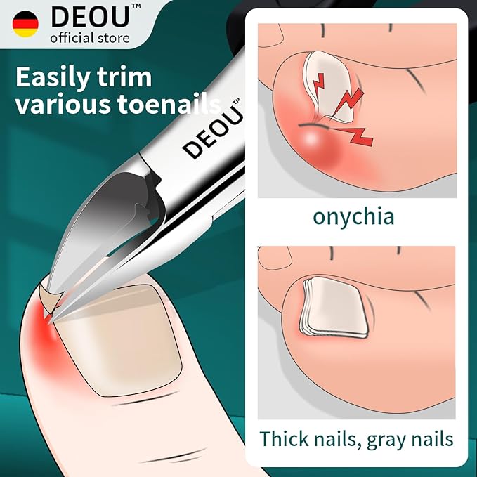 DEOU Toenail Clippers Blade for Ingrown and Thick Nails Stainless Steel Pedicure Tools at Home ingrown toenail Treatment Professional Podiatrist Nail Clippers with Upgraded Handle (Eagle Beak Pliers)