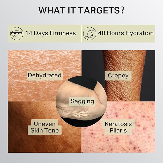 Ultra-Size Firming Retinol Body Lotion for Crepey Skin & Keratosis Pilaris with 0.05% Retinol, AHA, Collagen, Body Cream, Anti Aging Moisturizer 10.14 fl oz
