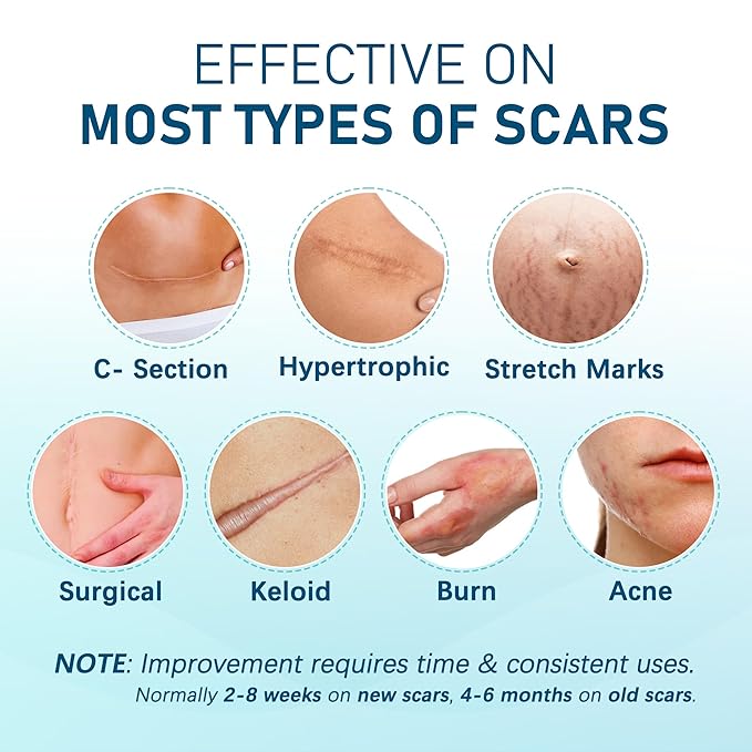 Silicone Scar Sheets, 10pcs, Silicone Tape for Scar Treatment, Reusable Scar Strips for Surgical, C-Section, Keloid Bump, Stretch Marks, Burn, Acne Scar Removal, Each 1.5” x 6”