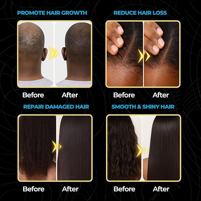 100% Pure Batana Oil – Raw, Organic & Unrefined Hair & Scalp Moisturizer | Natural Batana Hair Oil for Hair Growth | Rich in Vitamin E, Omega-6 & Phytosterols | Nourishes Dry & Damaged Hair – 4 oz