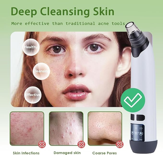 Blackhead Remover Pore Vacuum - Facial Pore Cleaner with 3 Adjustable Suction Levels, 4 Blackhead Removal Tools, Electric Acne Extractor Tool for Women & Men