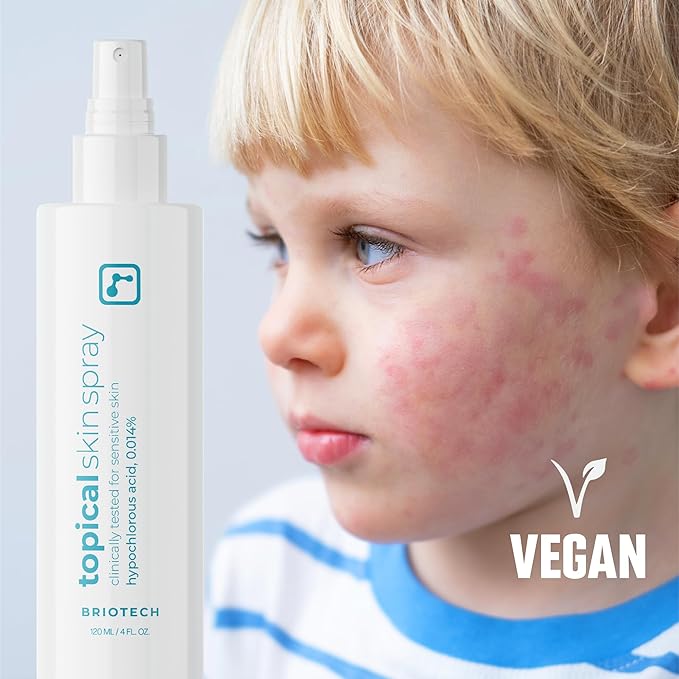 BRIOTECH Topical Skin Spray, Hypochlorous Acid Spray for Sensitive Skin, HOCl Facial Mist, Full Body Support Against Irritation, Calm Redness, Soothe Foot & Scalp, 4 oz (2 Pack)