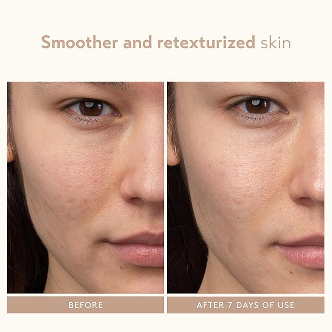 SHANI DARDEN SKIN CARE Lactic Acid Face Serum, Active Night Serum to Help with the Look of Radiant and Smooth Skin, Gentle But Powerful Face Exfoliator, 1.01 fl oz