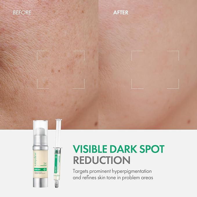Easydew DW-EGF Melatoning Ampoule 3X - Hydrating Dark Spot Serum with Niacinamide & Glutathione for Uneven Skin - Fast Absorbing Day & Night Ampoule Korean Skin Care (Bottle 1.01 fl oz, EGF 3X)