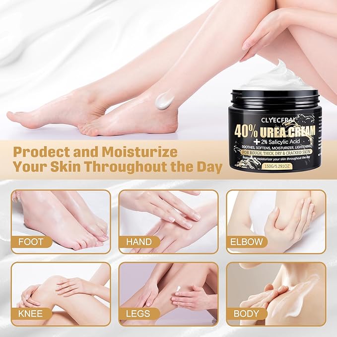 40% Urea Cream with 2% Salicylic Acid, Urea Cream 40 Percent for Feet & Hands- Maximum Strength Moisturizer for Rough, Dry, Thick & Cracked Skin, Callus Remover, Deep Hydration, 150g