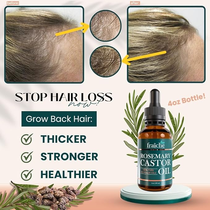Live Fraiche Rosemary Castor Oil for Hair Growth 4 Ounce - Cold Pressed Castor Oil and Rosemary Oil for Damaged Hair to Reduce Hair Loss
