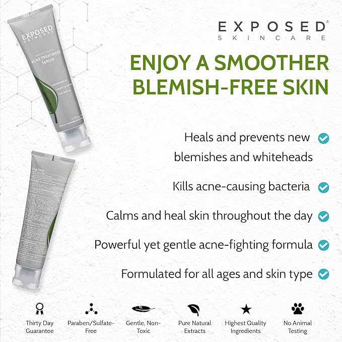 Exposed Skin Care, Acne Treatment Serum with 3.5% Benzoyl Peroxide – Lightweight Acne Spot Treatment – Quickly Clear Teen, Adult, Hormonal and Cystic Acne – Natural, Non-toxic and Cruelty Free