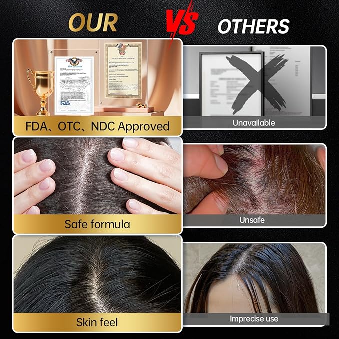 Minoxidil for Men & Women, With Biotin, Batana Oil, Rosemary Essential Oil, Effective Hair Loss Solution, Hair Loss Treatment for Hair Regrowth, Non-Greasy 5% Minoxidil - 60ml