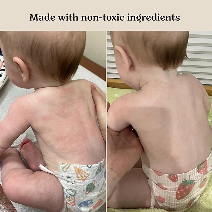 Roe Wellness- Baby Serum Hydrating Skincare EWG Verified Non-Toxic Ingredients Probiotic Protection | Hydrate, Soothe, Safe For All Skin Babies, Infants, Toddlers & Kids (Power Serum)