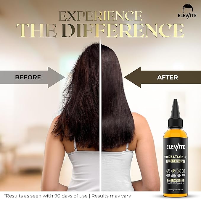 Elevate Batana Oil for Hair Growth | 100% Pure & Natural Raw Organic Oil from Honduras | Cold Pressed & Chemical-Free Serum for Thickness & Scalp Care Skin | Thicker Stronger Hair | 1 Pack | 4 Fl Oz