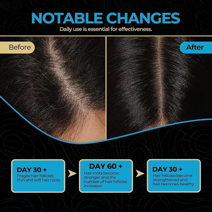 100% Pure Batana Oil – Raw, Organic & Unrefined Hair & Scalp Moisturizer | Natural Batana Hair Oil for Hair Growth | Rich in Vitamin E, Omega-6 & Phytosterols | Nourishes Dry & Damaged Hair – 4 oz