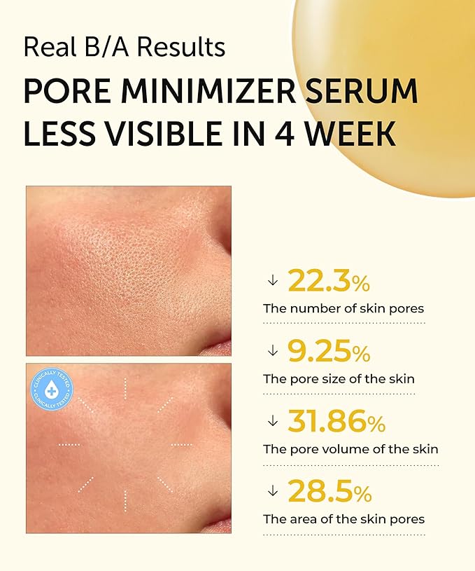SERUMKIND Pore tightening and Refining Serum Korean Face Skincare - Natural Salicylic acid - Yellowmello Extract 92% -1 fl.oz.