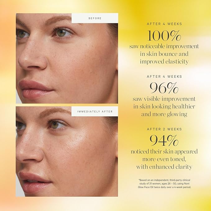 KORA Organics Noni Glow Hydrating Face Oil with Rosehip, Gua Sha Oil, Certified Organic, Cruelty Free, 1.01 fl oz - Beauty Products for Women