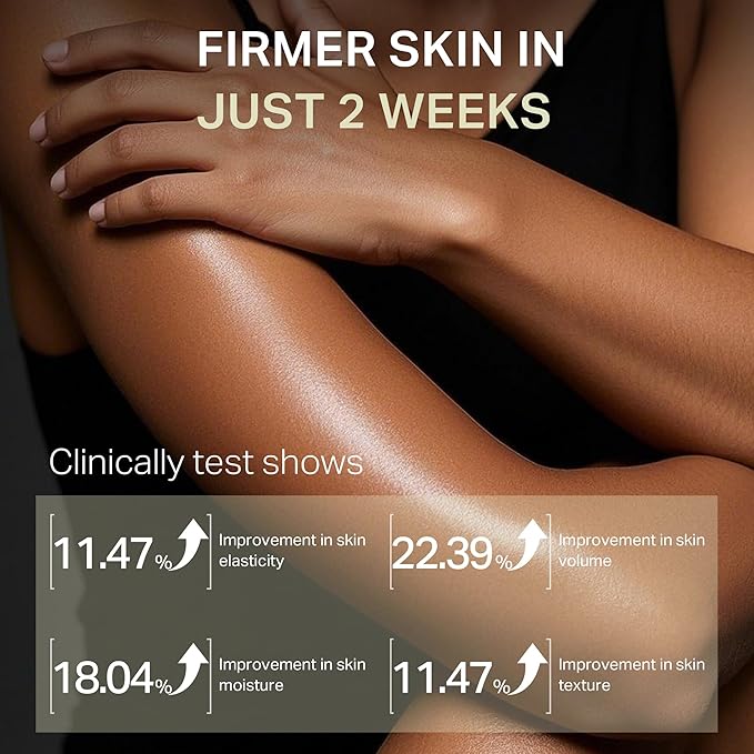 Ultra-Size Firming Retinol Body Lotion for Crepey Skin & Keratosis Pilaris with 0.05% Retinol, AHA, Collagen, Body Cream, Anti Aging Moisturizer 10.14 fl oz