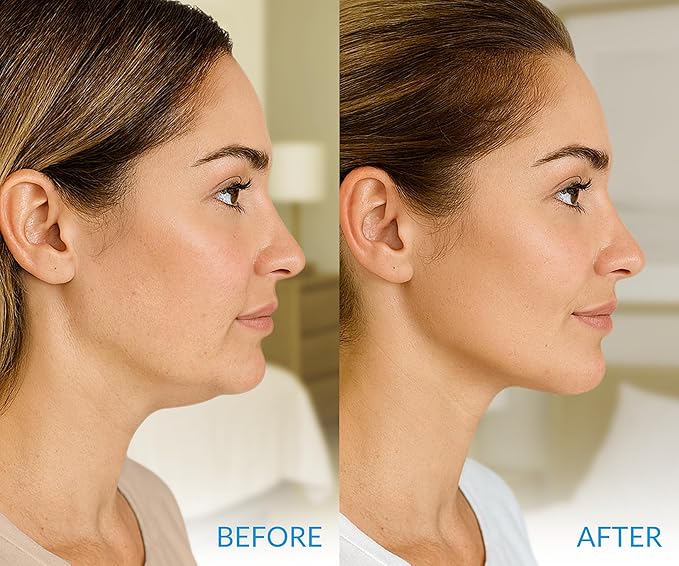 Stylia MaxiLift V-Line Lifting Collagen Face Mask - Advanced Double Chin Reducer - Jawline Shaper - Neck Firming and Tightening Mask with Hyaluronic Acid & Aloe Vera - Chin Strap for Sleeping (10PC)