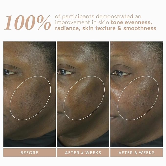 SHANI DARDEN SKIN CARE Retinol Reform with 1% Encapsulated Retinol Serum for Face & Neck, Gentle Slow-Release Retinol Face Serum with Tripeptide for Wrinkles, Fine Lines & Uneven Tone, 0.3 fl oz