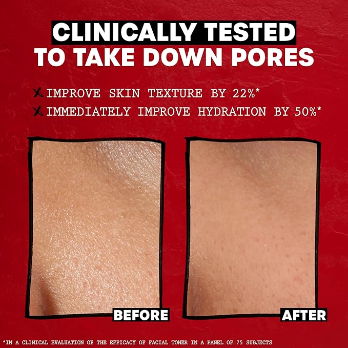 THAYERS Alcohol-Free, Hydrating Original Witch Hazel Facial Toner with Aloe Vera Formula, Vegan, Dermatologist Tested and Recommended, 12 Oz (Packaging May Vary)