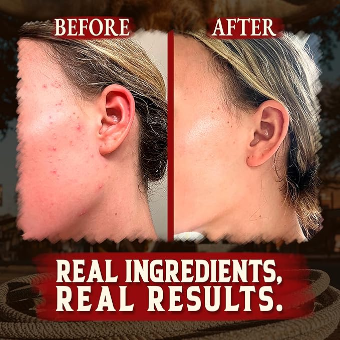 Organic Beef Tallow for Skin - 4 OZ (Unscented) — Grass Fed Beef Tallow for face + Body — US-Made Whipped Tallow and Honey Balm Moisturizer for Dry and Sensitive Skin, Eczema, Rosacea (No Additives)
