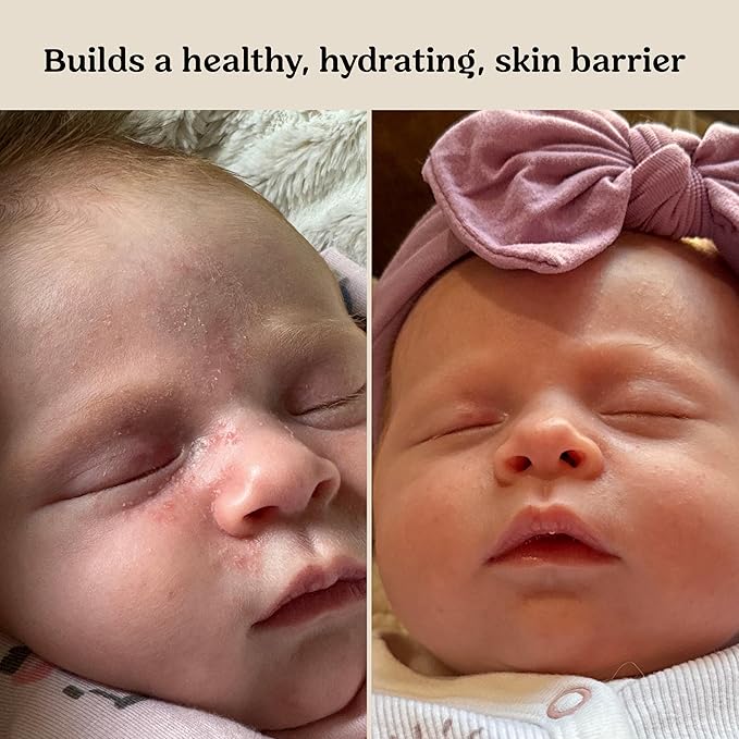 Roe Wellness- Baby Serum Hydrating Skincare EWG Verified Non-Toxic Ingredients Probiotic Protection | Hydrate, Soothe, Safe For All Skin Babies, Infants, Toddlers & Kids (Power Serum)