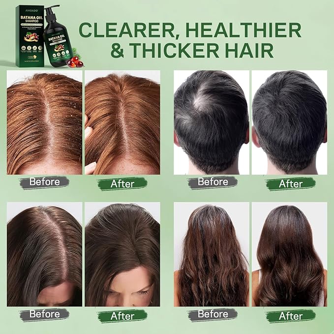 Batana Oil Shampoo for Hair Growth, Strengthening, Thickening, Sulfate Free Hair Shampoo for Women & Men with Thinning Hair & Hair Loss, Infused Rosemary, Tea Tree Oil & Mint, 10.15 fl.oz
