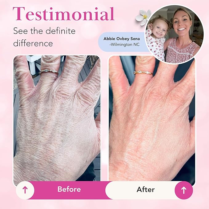 Theraplex Clear Emollient Lotion (8 oz) - No Parabens or Preservatives, Noncomedogenic and Hypoallergenic, Fragrance Free, Dermatologist recommended (2 Pack - Pour)