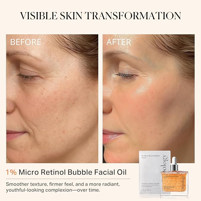 1% Retinol Face Oil with Firming, Smoothing & Glowing– Retinol Serum for Face, Lightweight Squalane Facial Oil for Fine Lines, Texture & Anti-Aging, Gentle for All Skin 1.01 fl oz
