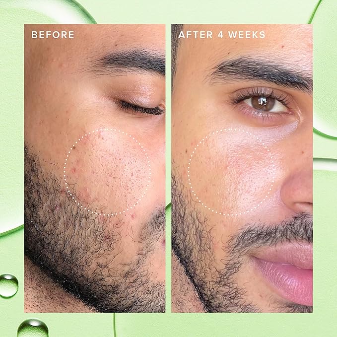 Farmacy 2% Salicylic Acid Toner for Face - Deep Sweep Gentle BHA Exfoliant for Oily Skin - Refines Texture with Papaya Enzymes & Moringa Water for a Healthy-Looking Complexion (50ml)