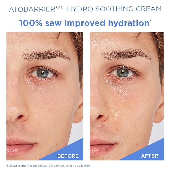AESTURA ATOBARRIER365 Hydro Soothing Gel Cream Moisturizer with Ceramides for Moisture Barrier Repair | Lightweight Hydration, Instant Cooling, Suitable for Sensitive Skin, 60ML / 2.03 fl.oz.